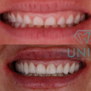 Oral Rehab Complete