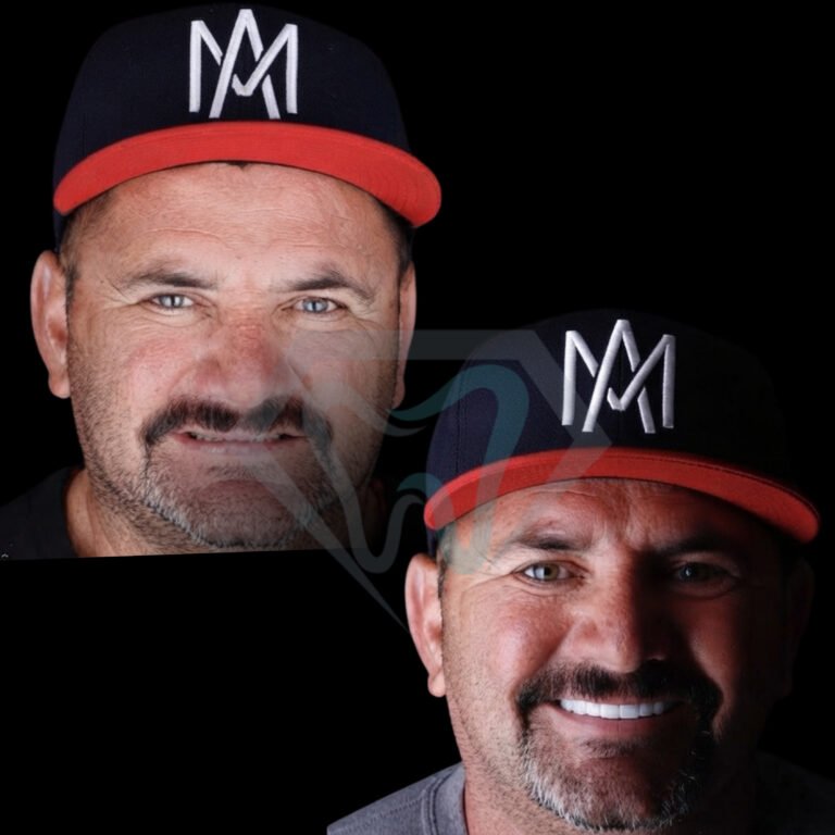 casouniket5
